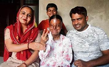 “Chandigarh Teen Overcomes Acid Attack to Score 95.6% in Class 12 Boards”